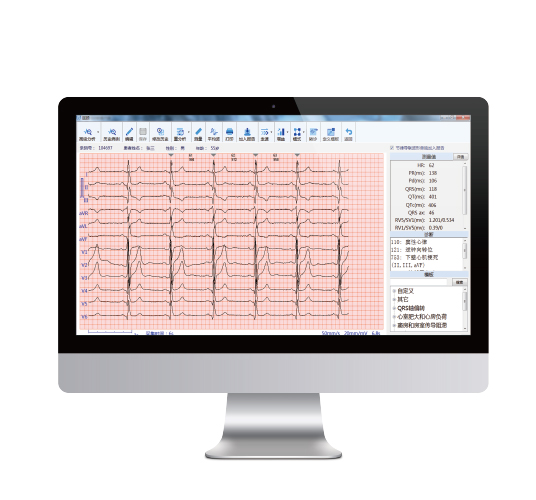 AI-ECG 人工智能心电辅助分析技术
